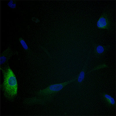 HO-1 Protein Expression in THLE2 Liver Cells before taking a sulforaphone & maitake supplement