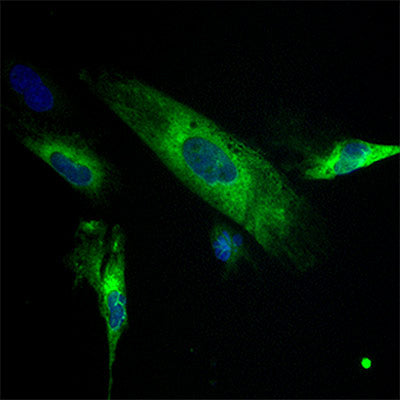 HO-1 Protein Expression in THLE2 Liver Cells after taking a sulforaphone & maitake supplement
