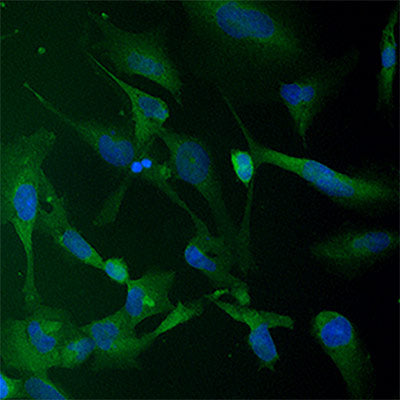 NQO1 Protein Expression in THLE2 Liver Cells without sulforaphane & maitake mushroom extract