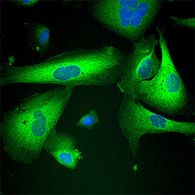 NQO1 Protein Expression in THLE2 Liver Cells after taking sulforaphane-producing supplement and maitake mushroom extract