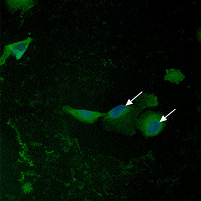 Translocation of NRF2 into the Nucleus without Exposure to Sulforaphane and Maitake Mushroom Extract