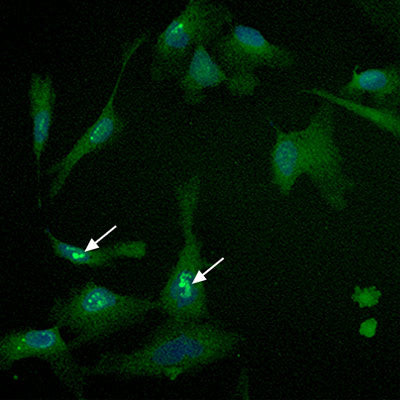 Translocation of NRF2 into the Nucleus Following Exposure to Sulforaphane and Maitake Mushroom Extract